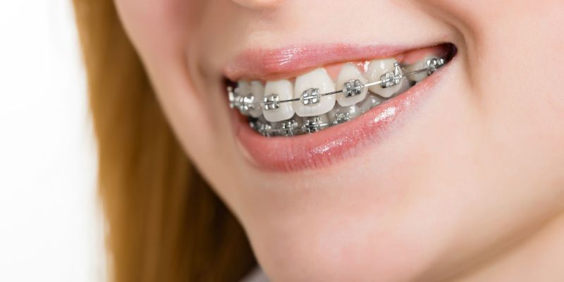 Orthodontics Is About More Than Braces
